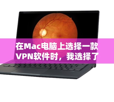 在Mac电脑上选择一款VPN软件时,我选择了端口隐藏,因为它符合我的需求和特点 在Mac电脑上选择一款VPN软件时,我选择了端口隐藏,因为它符合我的需求和特点